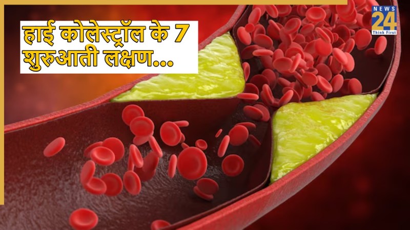 source-high cholesterol symptoms -1