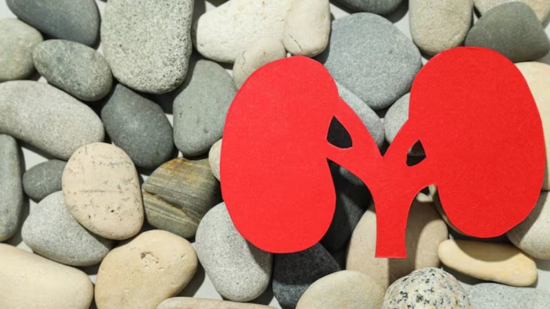 high uric acid symptoms high uric acid symptoms-1-2-3-4-5-6-7