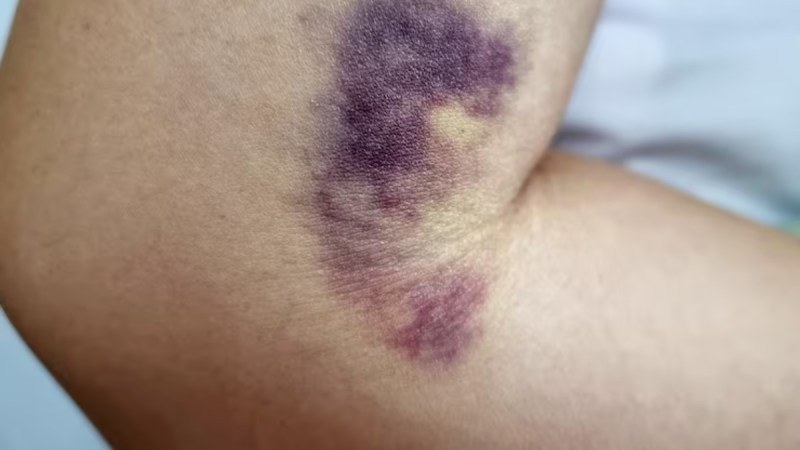 high uric acid symptoms high uric acid symptoms-1-2-3-4-5-6-7-8