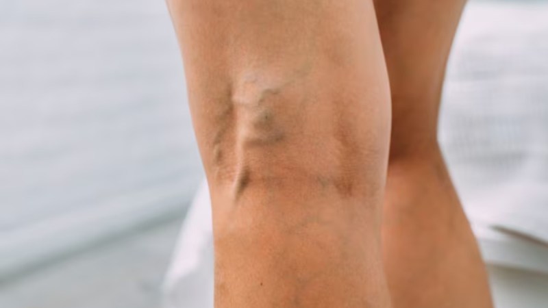 source-hiv aids hiv aids-1-2-3-4