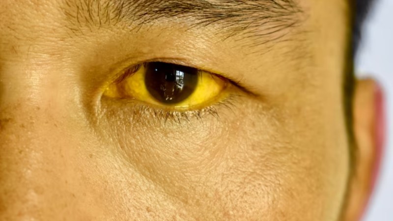 source- liver cancer -1-2-3