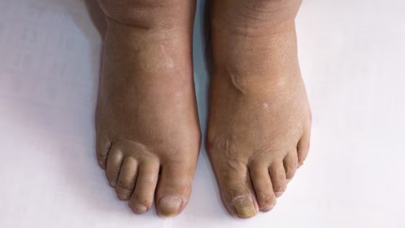 source- liver cancer -1-2-3-4-5-6-7