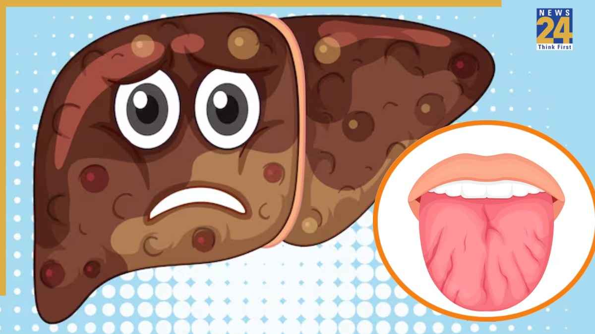 source-liver damage