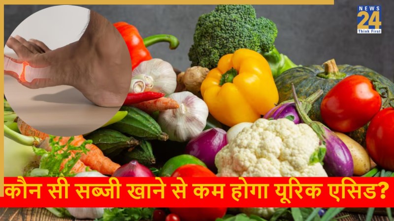 source- uric acid uric acid-1