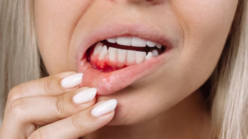 source-vitamin c -1-2-3-4