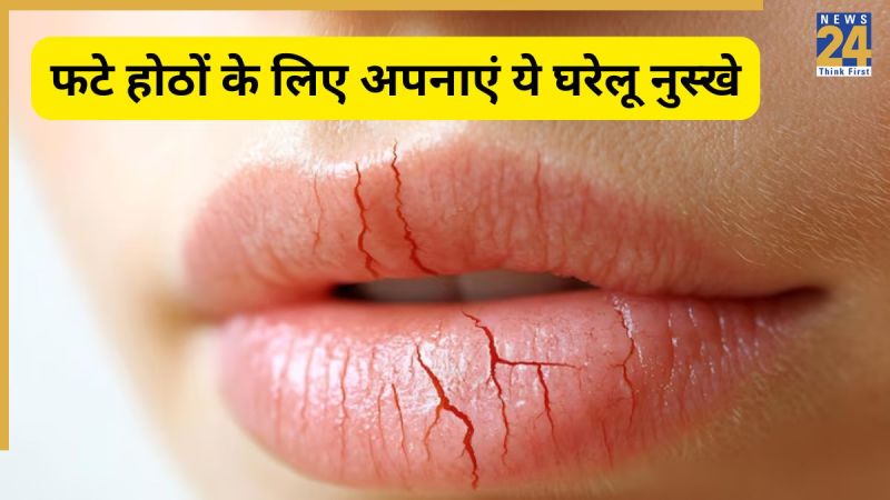 Chapped Lips Remedies