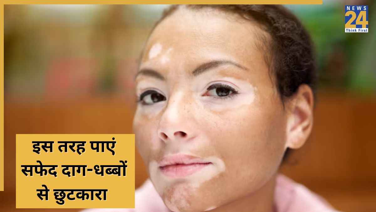 White Spots on Face