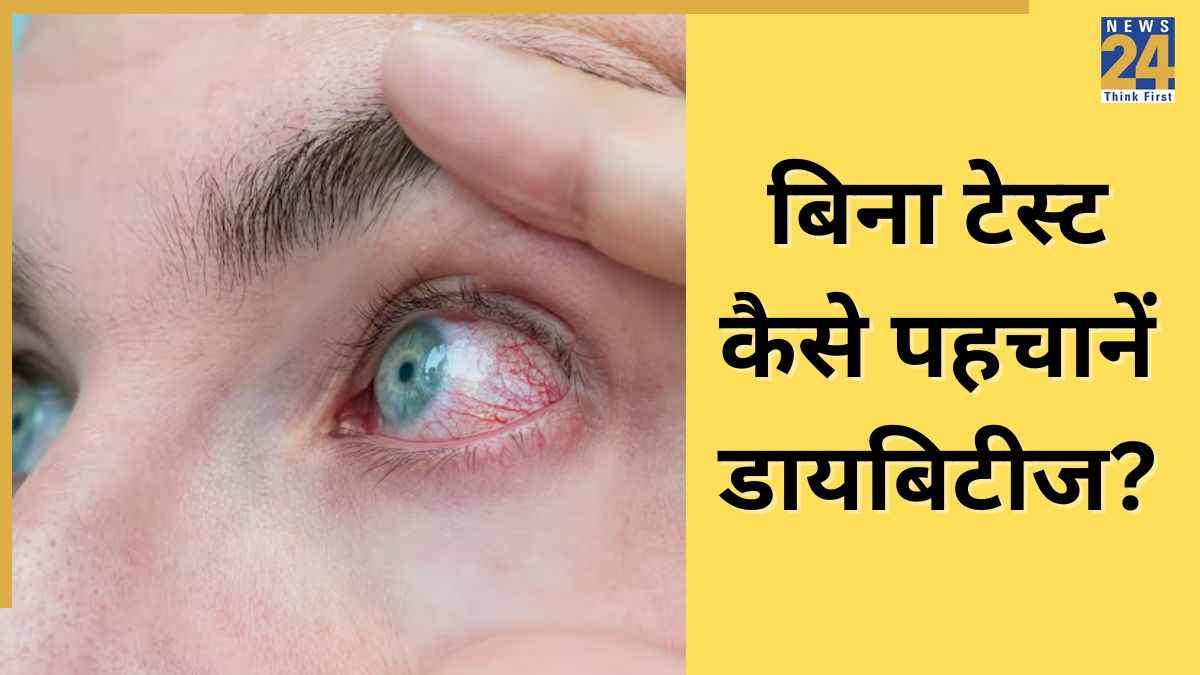 डायबिटीज से आंखों को हो सकता है गंभीर नुकसान. Image Source Freepik