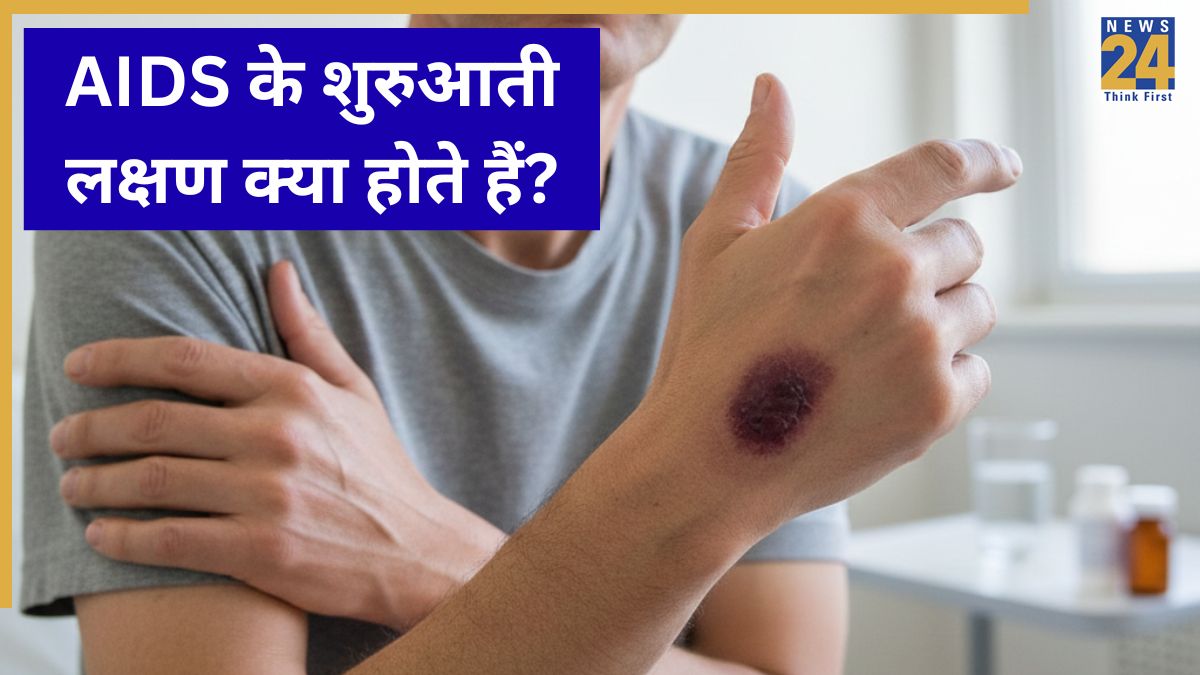 AIDS Symptoms In Men AIDS Symptoms In Men-1