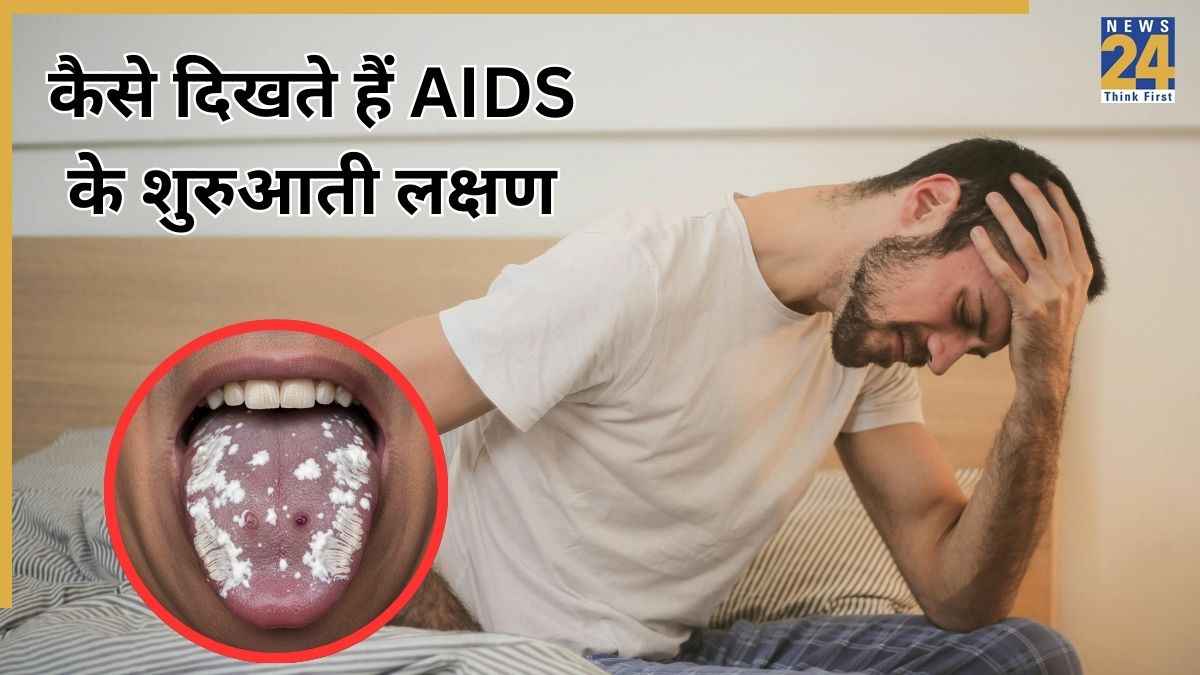 AIDS Symptoms
