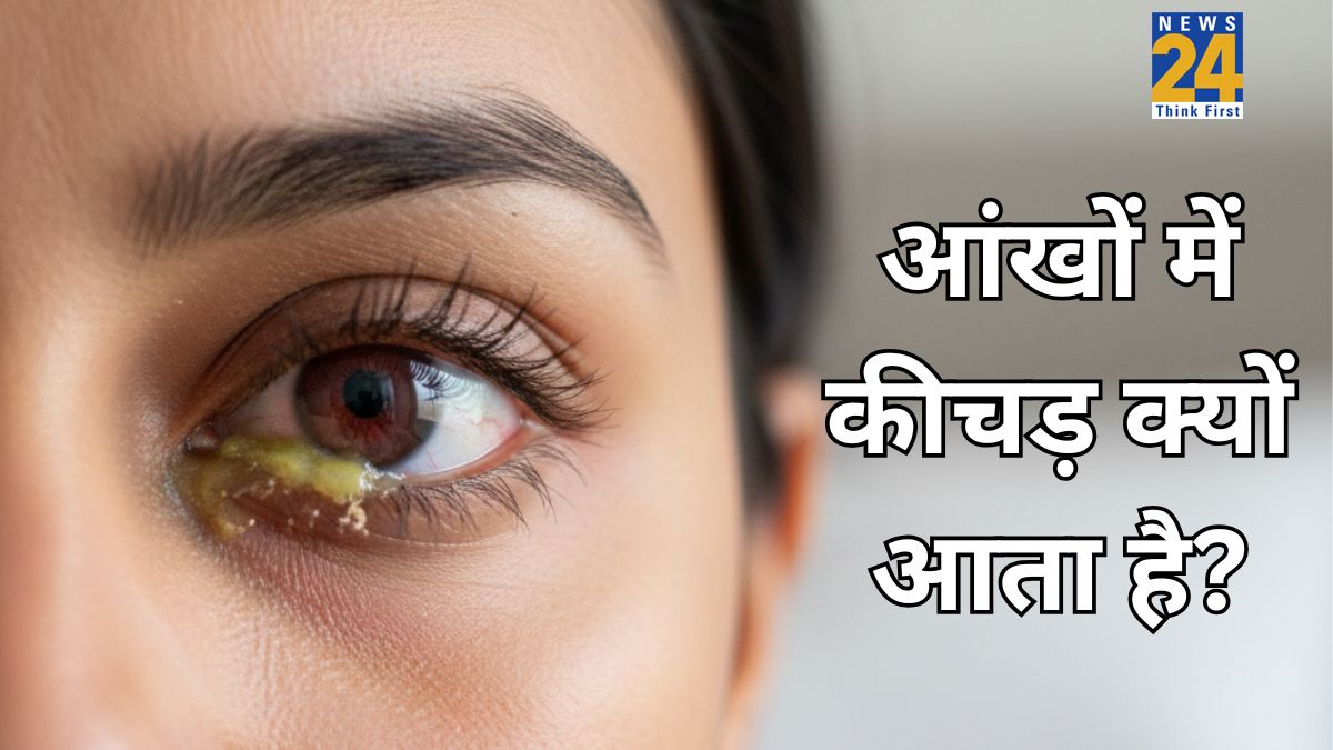 Aankh me kichad kyu aata hai Aankh me kichad kyu aata hai-1