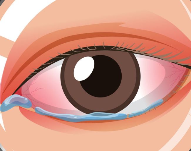 Aankh me kichad kyu aata hai-1-2-3-4-5-6-7