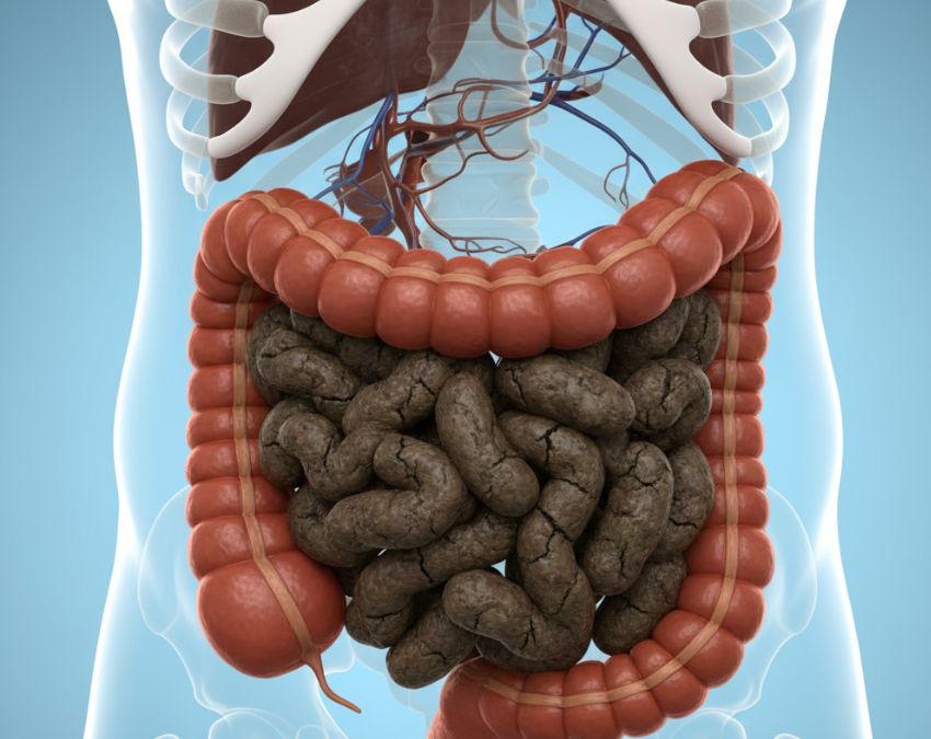 Colon Cancer-1-2-3-4-5-6-7