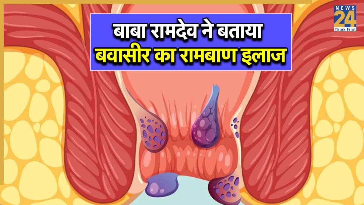 Bawasir Ka Ilaj