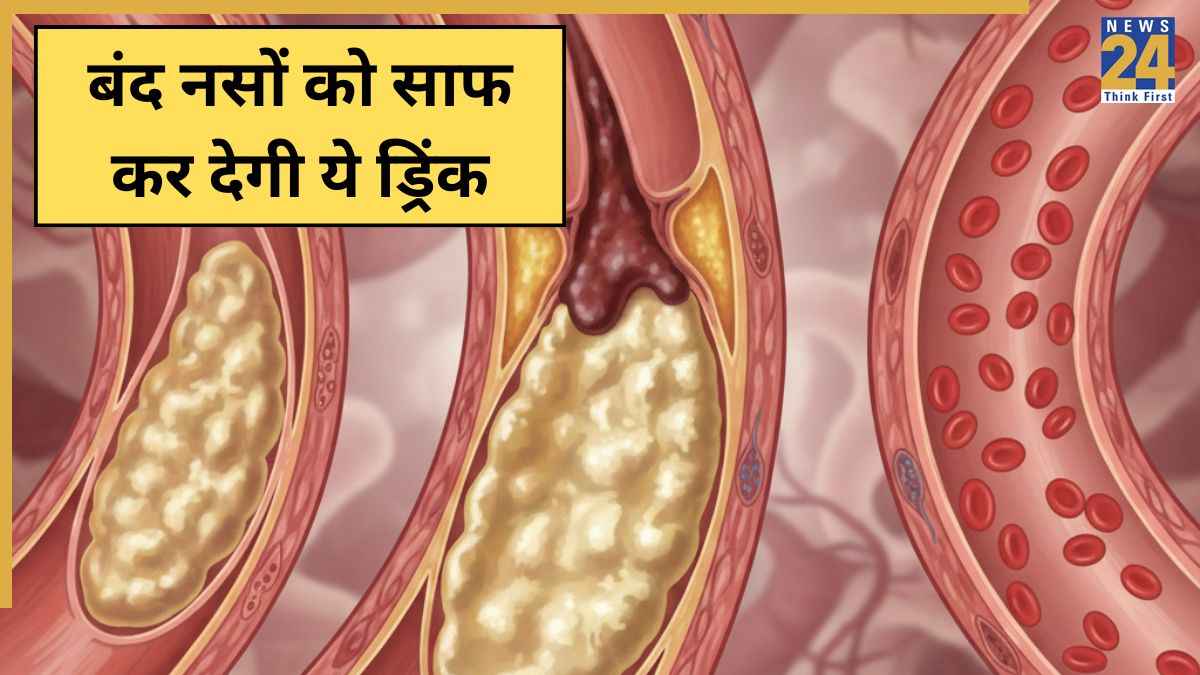 Blocked Arteries