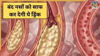 Blocked Arteries