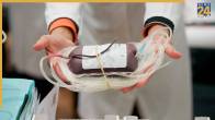 Blood Transfusion