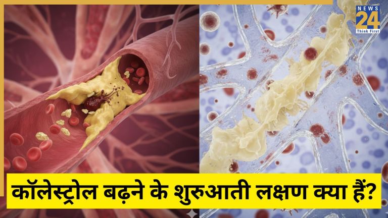 कोलेस्ट्रॉल बढ़ने पर शरीर में क्या-क्या लक्षण दिखाई देते हैं?
