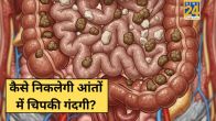 Constipation