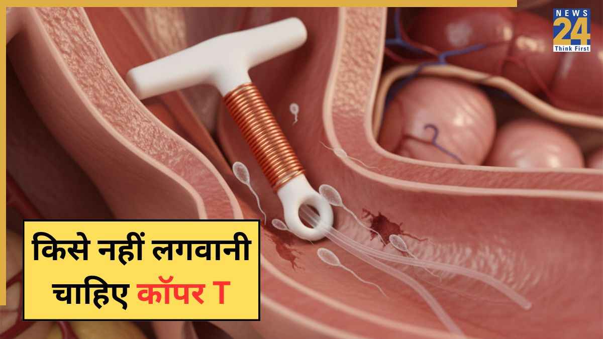 Copper T या कॉपर आईयूडी क्या है? डॉक्टर ने बताया कॉपर टी डालने में कितना दर्द होता है और किसे कभी नहीं लगवाना चाहिए