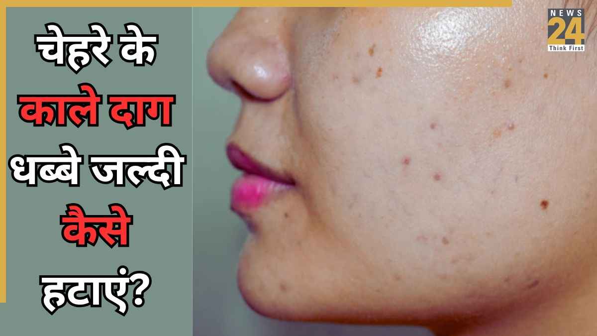 Dark Spots: सूरज की तरह चमकने लगेगा चेहरा, रोजाना इस्तेमाल करें ये 3 चीजें, कुछ ही दिनों में नजर आएगा फर्क