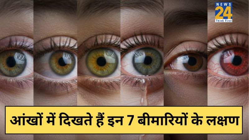 Disease signs in eyes