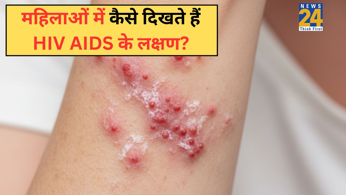 HIV AIDS Symptoms In Women-1