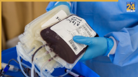 HIV Positive Blood