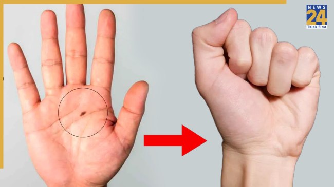 Hiding Mole On The Palm Meaning