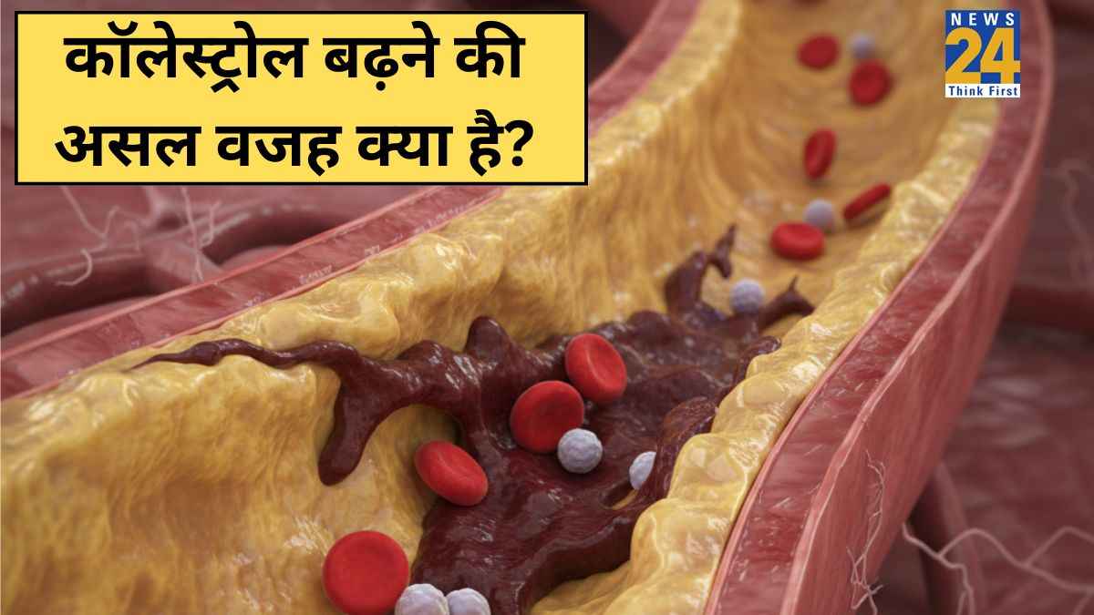 कोलेस्ट्रॉल बढ़ने का मुख्य कारण क्या होता है? डॉक्टर ने बताई High Cholesterol की असल वजह