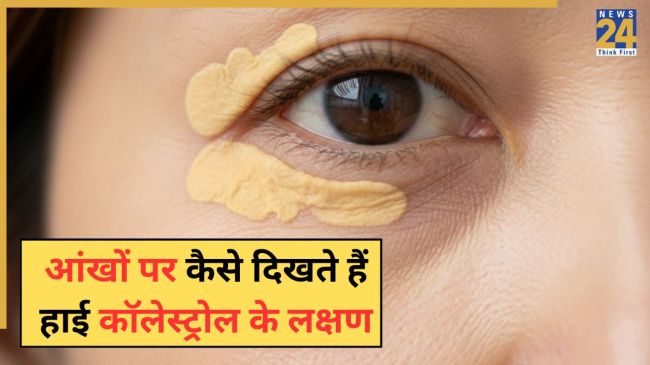 High Cholesterol Symptoms