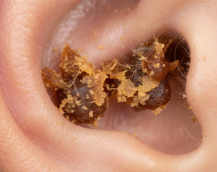 kaan ki gandagi kaise saaf kare kaan ki gandagi kaise saaf kare-1-2-3-4-5-6-7