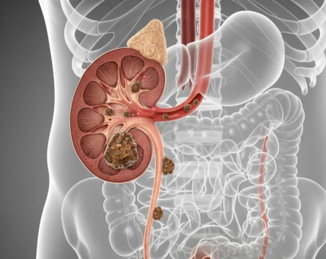 Peshab Rokna-1-2-3-4-5-6