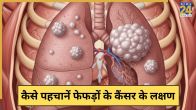 Lung Cancer