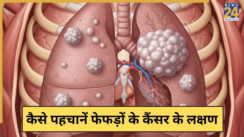 Lung Cancer Lung Cancer