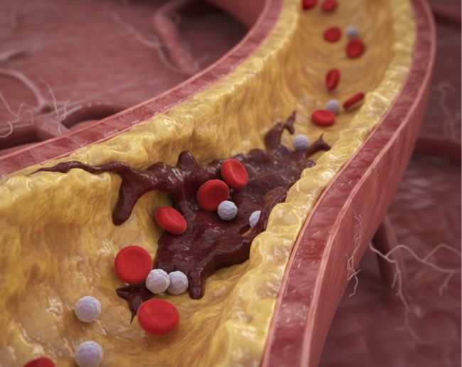 Peshab me jhag aane ka karan-1-2-3-4