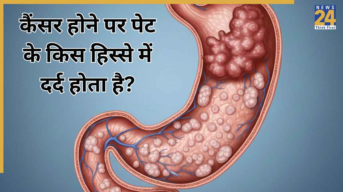पेट के कैंसर में कहां दर्द होता है? डॉक्टर ने बताया पेट के कैंसर का पहला संकेत क्या है