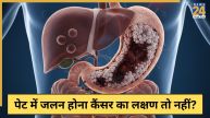 Stomach Cancer Symptoms