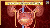 UTI Causes