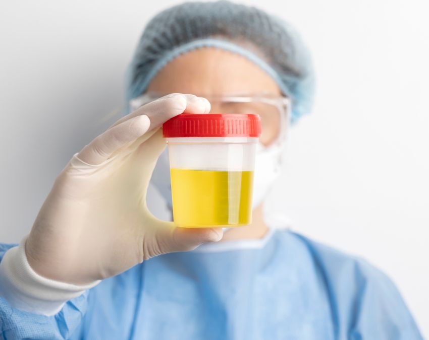 Baar Baar Peshab Aana Peshab Me Jalan-1-2-3-4