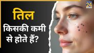 Which Deficiency Causes Moles On face in Hindi