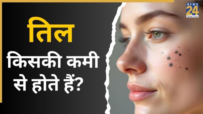 Which Deficiency Causes Moles On face in Hindi
