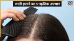dandruff home remedies
