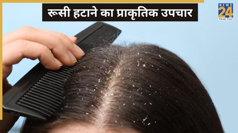 dandruff home remedies
