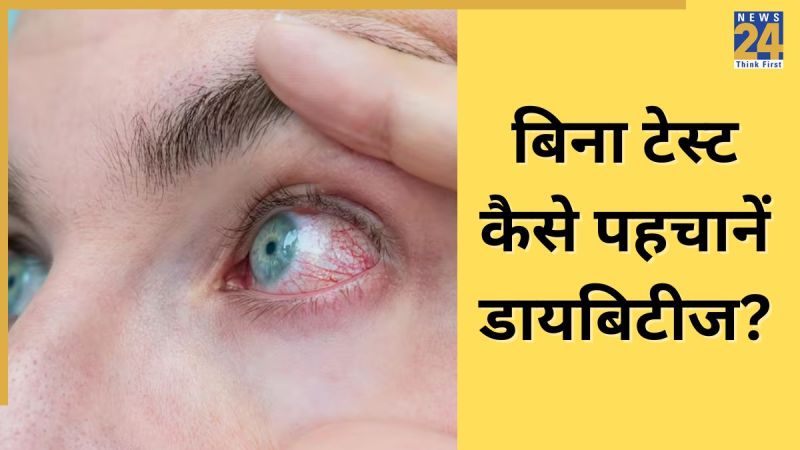 डायबिटीज से आंखों को हो सकता है गंभीर नुकसान. Image Source Freepik
