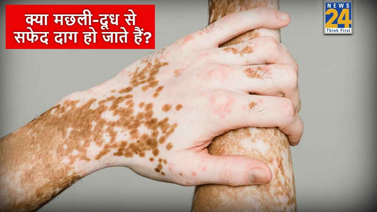 क्या सच में मछली खाने के बाद दूध पीने से शरीर पर सफेद दाग हो जाते हैं? सच्चाई जानकर सिर पकड़ लेंगे आप