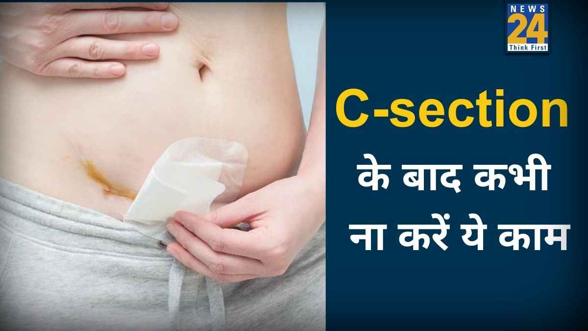 सिजेरियन डिलीवरी के बाद क्या-क्या परहेज करना चाहिए? जानिए C-section के बाद कैसे करें रिकवर