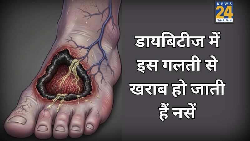 Diabetes Nerve Damage