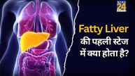 Fatty Liver