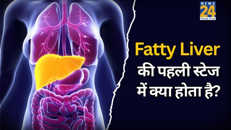 Fatty Liver